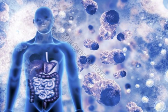 A Chronic Respiratory Problem Could Be Caused By An Overactive Immune System.